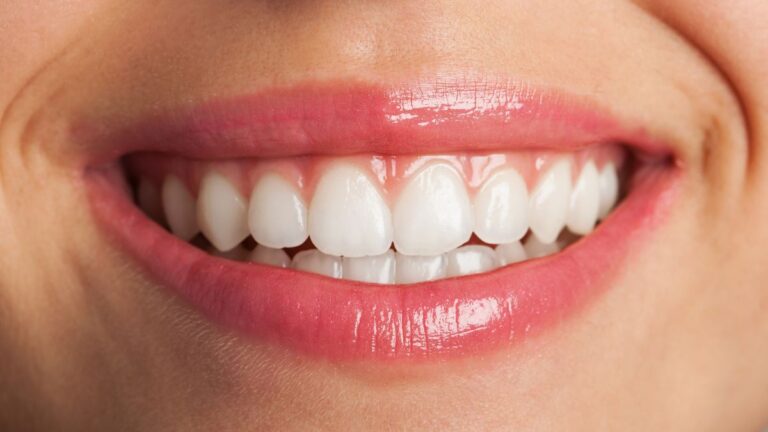 sbiancamento dei denti
